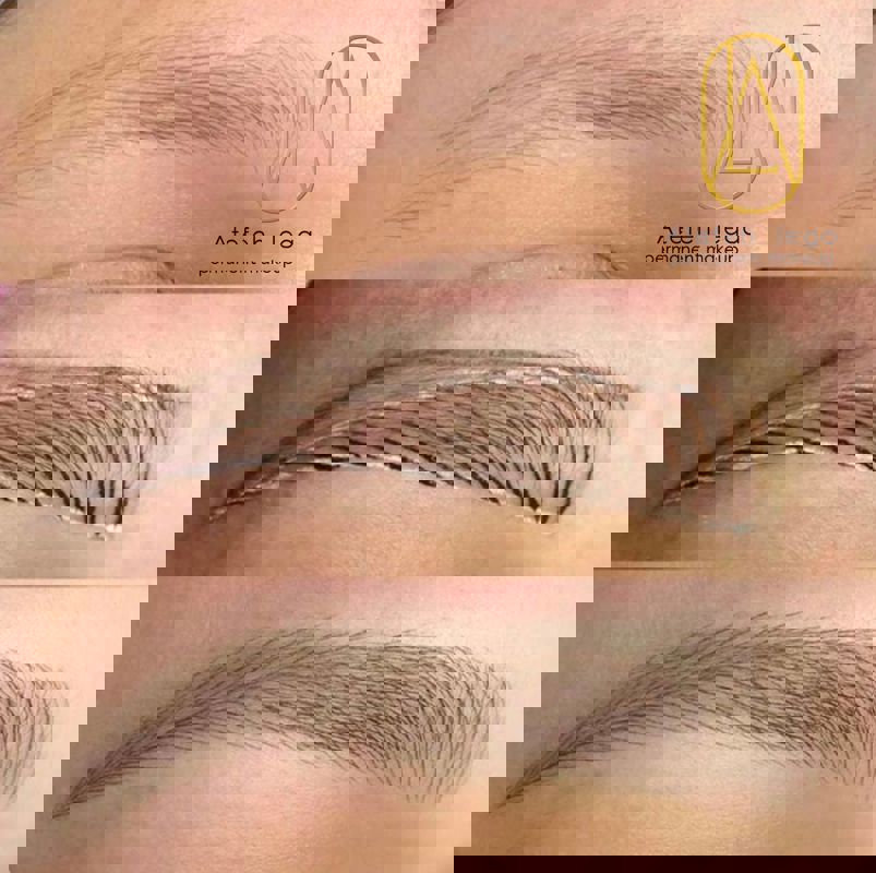 میکروبلیدینگ