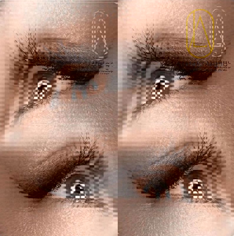 خط چشم دائم